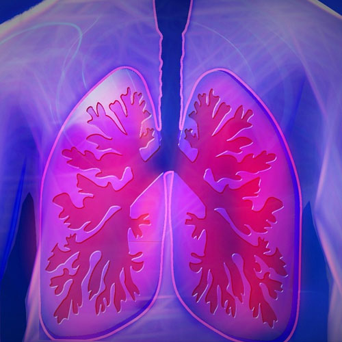 COPD